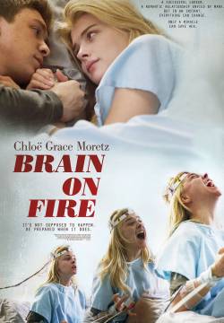 Brain on fire (2017)
